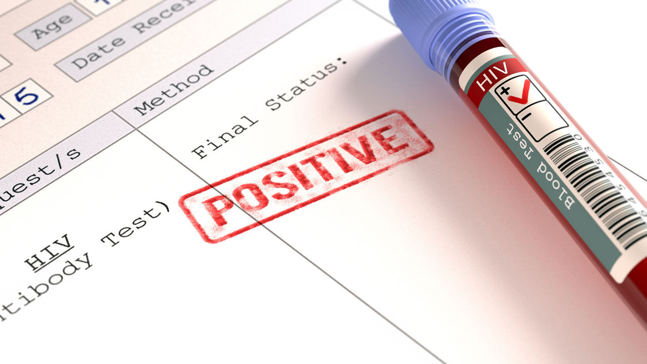 HIV Positive