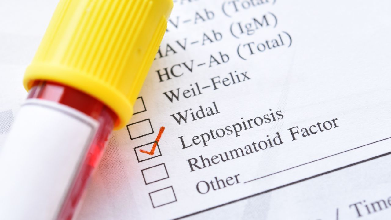 Leptospirose : Un comité de suivi et de coordination mis en place