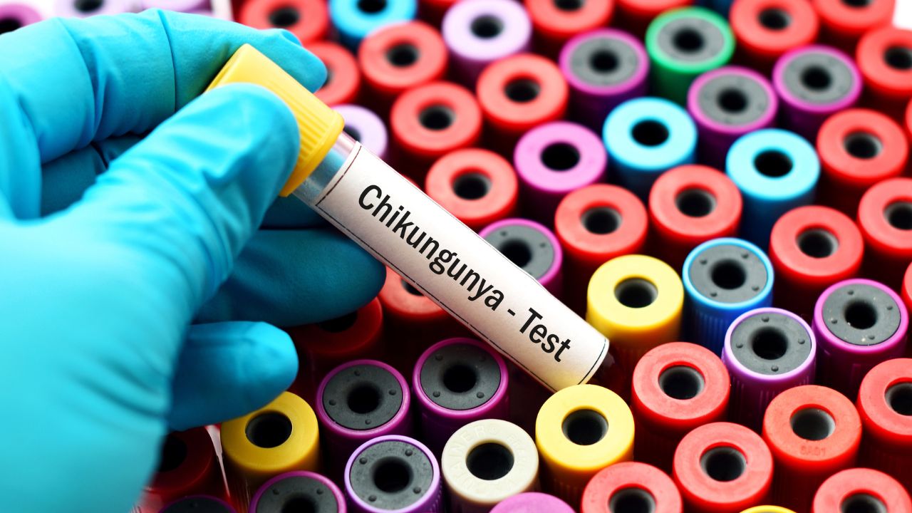 chikungunya test photo d'illustration