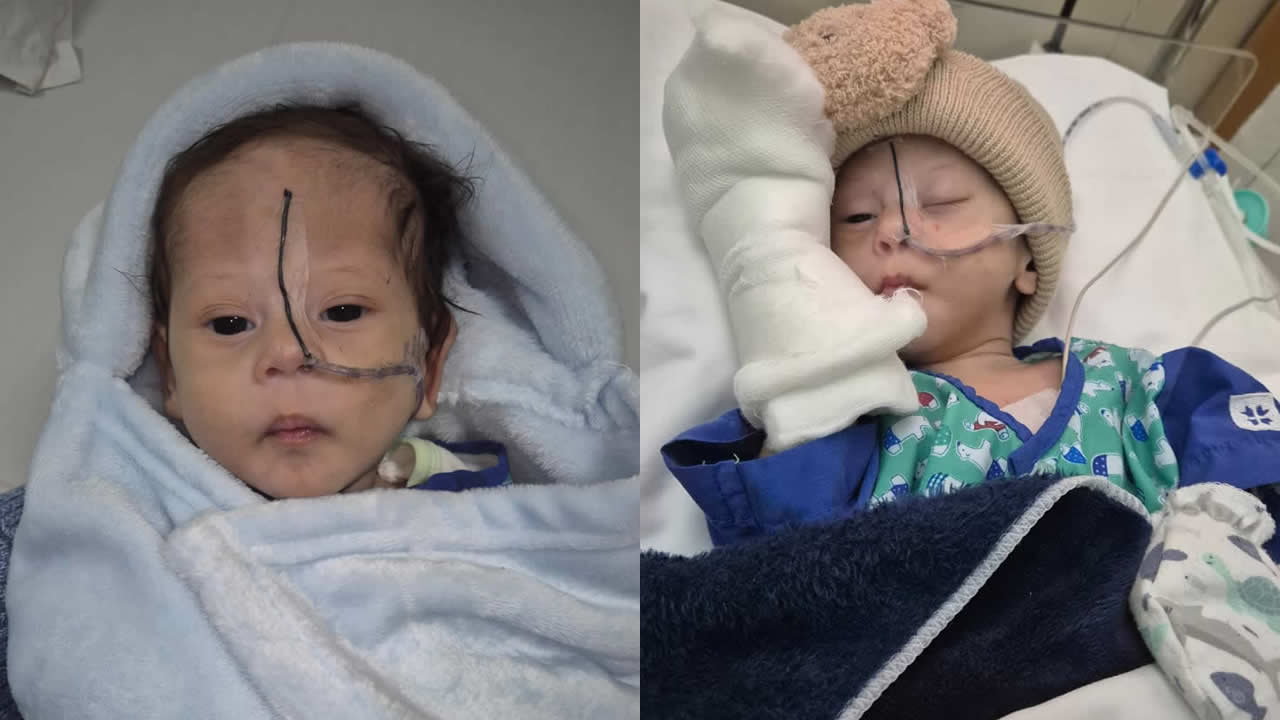 Le petit Ezekiel a subi une intervention délicate.