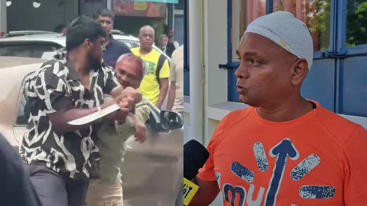 Le taximan Iqbal Meeajan porte les séquelles de son agression.