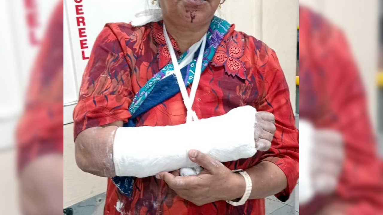 La victime a le bras fracturé après cette agression.