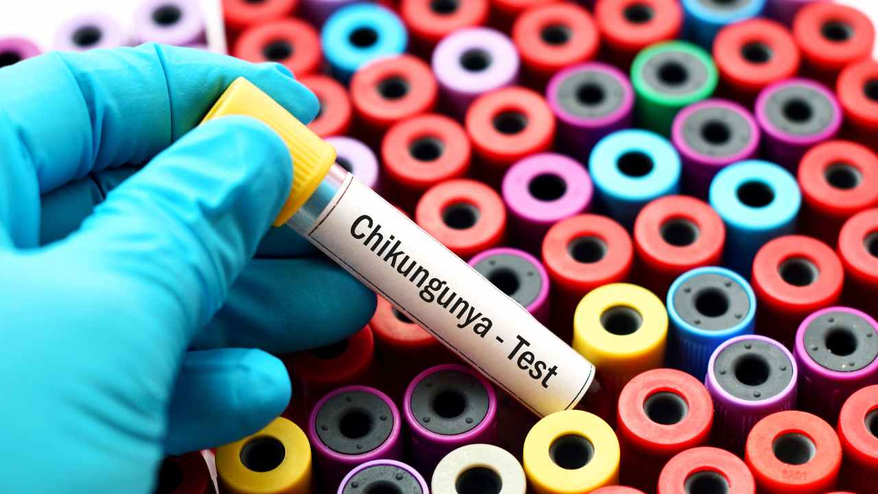 Chikungunya 