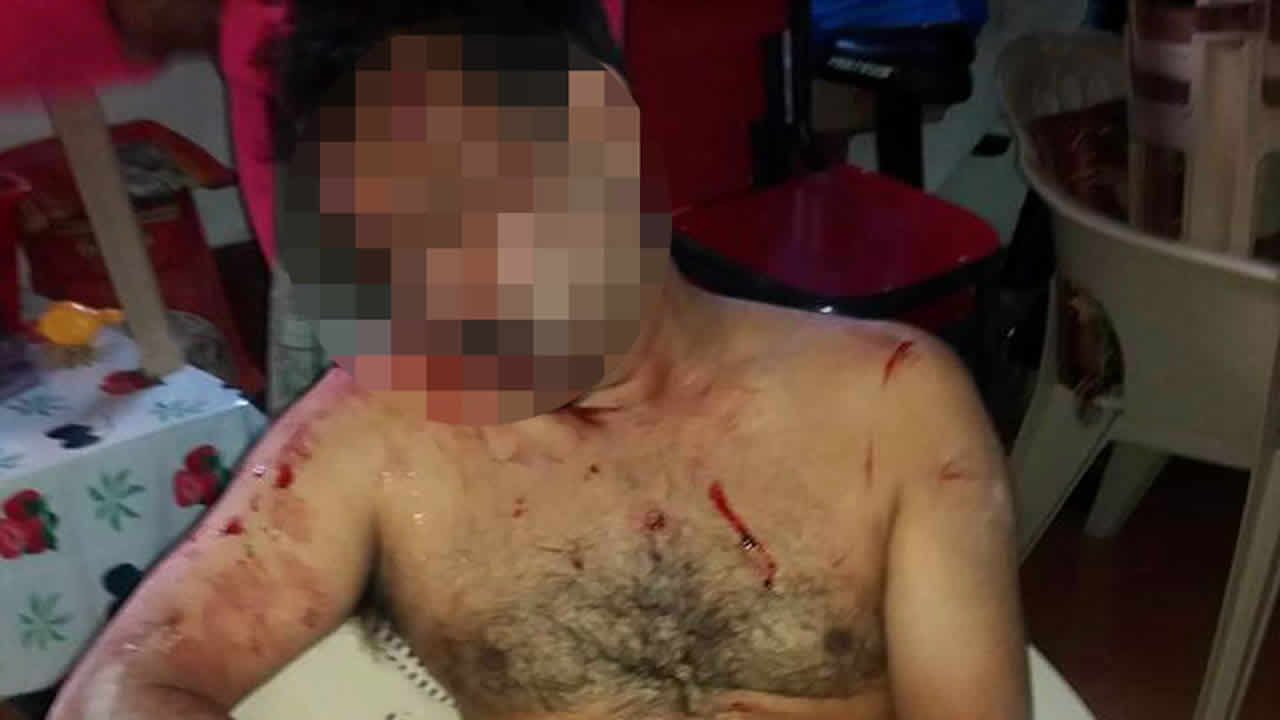 Kanaven, la victime.