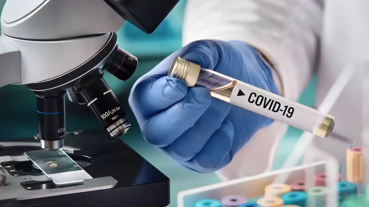 Covid-19