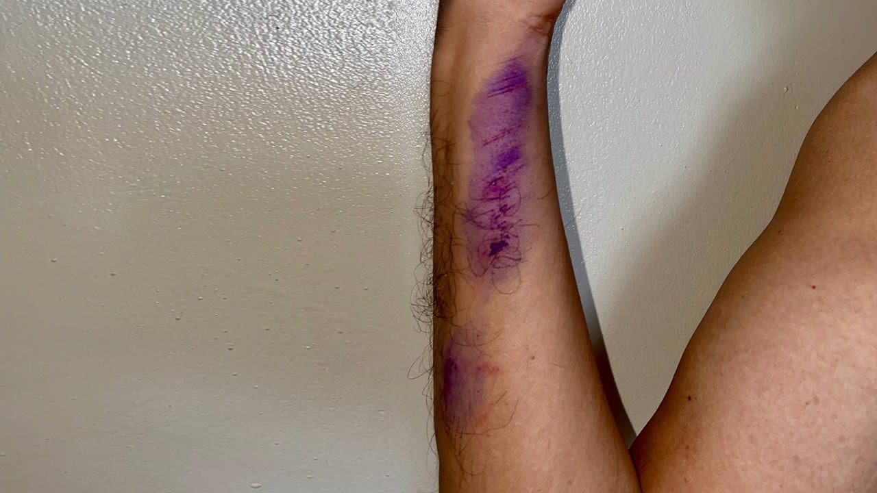 Rajiv se dit traumatisé depuis l’attaque des chiens.