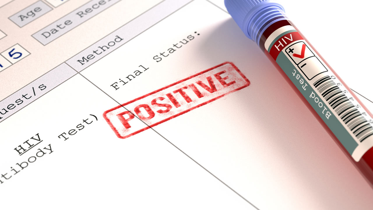 HIV