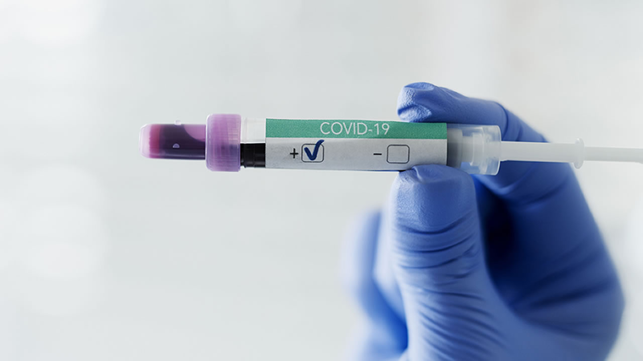 covid positive