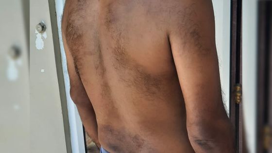 Independent Police Complaints Commission : un chauffeur de taxi porte plainte pour brutalité policière