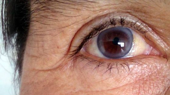 Hôpital de Moka : faute de médecin, une personne âgée ne peut être opérée 