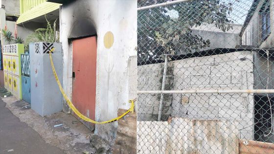 Incendie à Bain-des-Dames : un retraité de 73 ans brûlé aux mains et au visage 