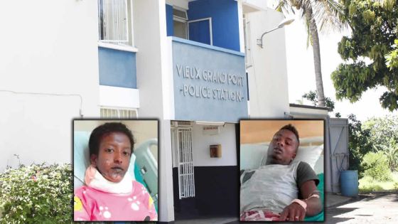 Incendie à Anse-Jonchée: la police soupçonne un ‘foul play’