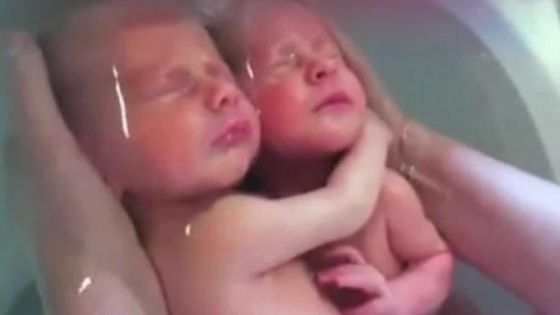 Les jumelles sont nées - La maman : «Merci de votre générosité»