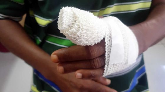 Amputé au niveau du doigt sur son lieu de travail, il est licencié