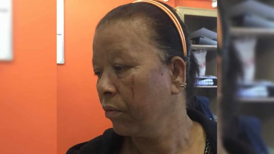 Hôpital SSR : une infirmière griffe une patiente au visage 