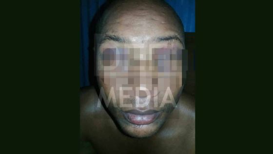 Règlement de comptes : un jardinier agressé et menacé de mort