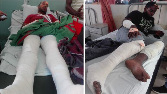 Règlement de compte à Calodyne : accusés de semer la terreur deux cousins tabassés