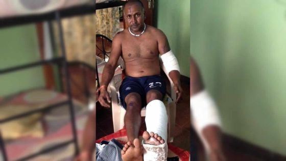 À Rivière-des-Créoles : un maçon agressé au gourdin par un boutiquier