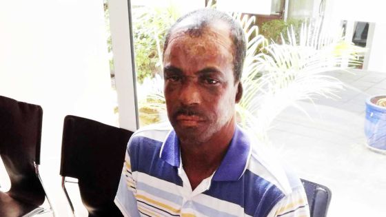 Privé de l’usage de ses mains : il ne bénéficie plus d’une pension d’invalidité