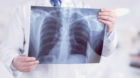 Contrats publics : l’IRP reproche à la Santé son absence de rigueur