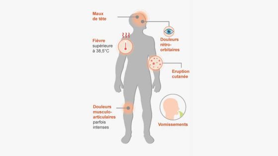 Virus : avis divergents sur le risque que la dengue ne devienne endémique