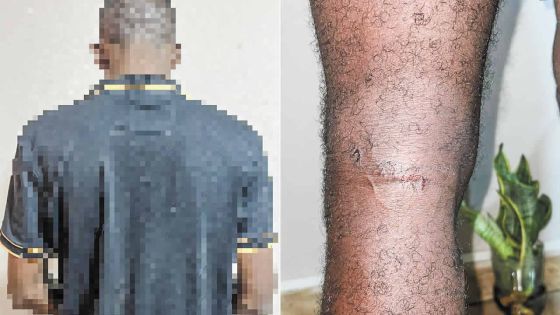 Au cœur d’une opération de remise de rançon - Amberly, la compagne de la victime : «Ti kouma dan enn fim daksion»