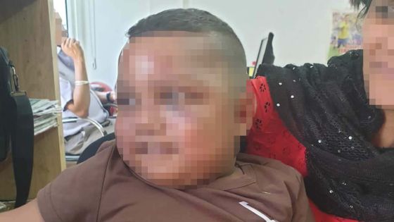 Dans une école pré -primaire : un enfant de 3 ans blessé après une chute