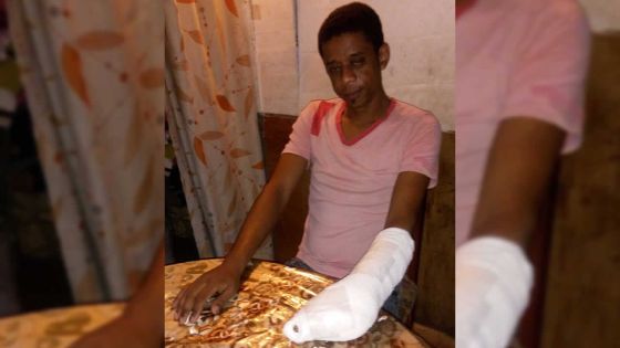 Accident de travail : Joseph a quatre doigts sectionnés