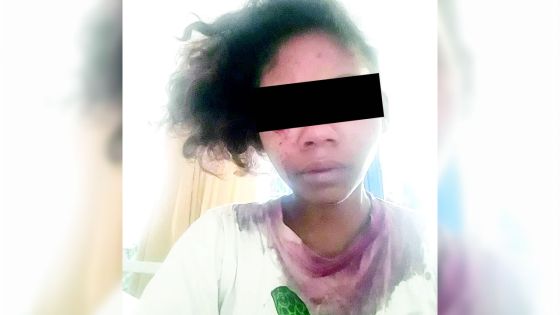 Résidence La Cure : elle allègue avoir été tailladée par une adolescente de 16 ans 