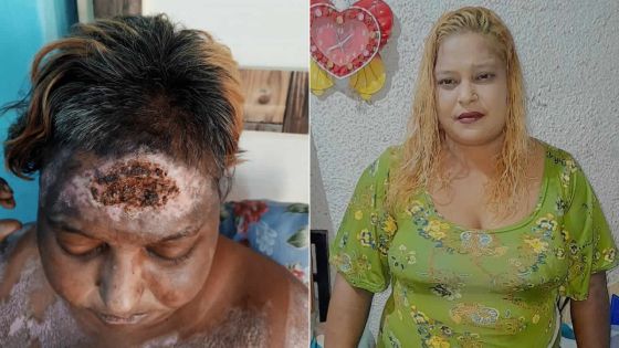 Décès de Faeza Rawa après une attaque au cocktail Molotov 