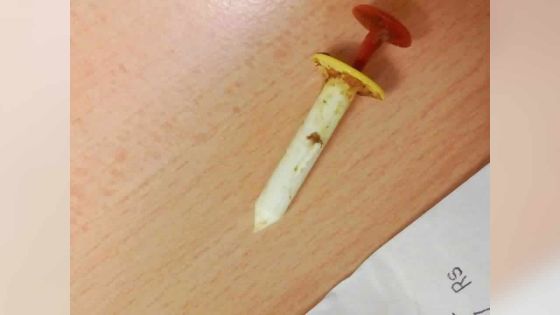 Un corps étranger dans une dinde : l’importateur explique que c’est un ‘timer’