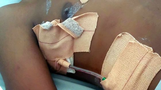 À Bois-Marchand : un ado poignarde son ami lors d’un combat de boxe