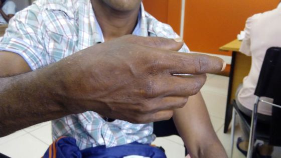 Handicapés : ils lancent un appel au ministre de la Sécurité sociale