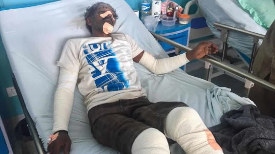 Agression à Curepipe : 10 coups de couteau pour une cigarette