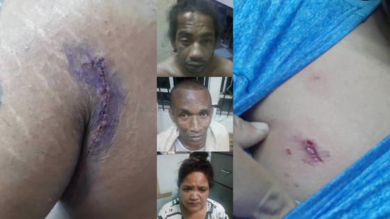 Un policier agressé à la poitrine, un autre mordu au bras et au cou