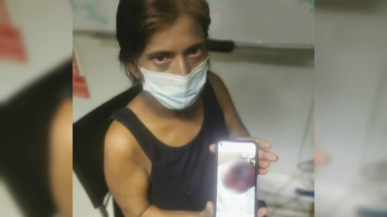 Un nourrisson décède après une césarienne - La grand-mère : «Ena bann mark koupe lor so latet ek so lekor»