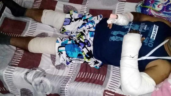 Dans le Nord : une querelle de voisinage dégénère en violente agression