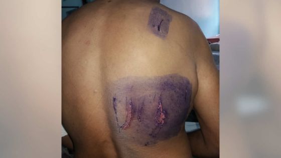 Hôpital Brown-Séquard : Il allègue que son frère a été frappé par le personnel 