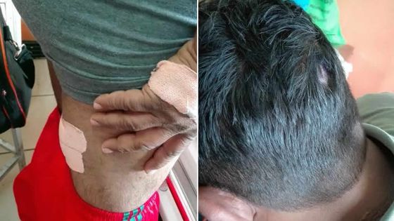 Nouvelle-France: le propriétaire d’une station-service agressé avec une «fouine»