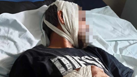 Le neveu veut de l’argent : il agresse son oncle à l’arme blanche