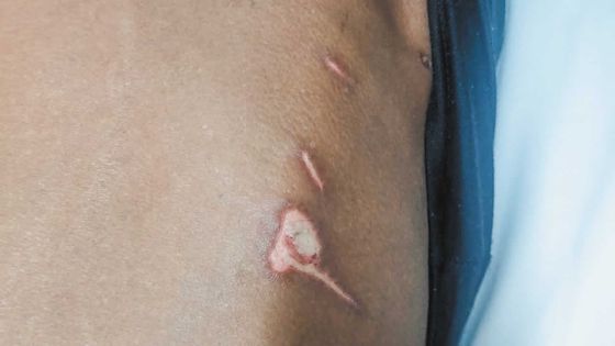 Un retraité retrouvé en sang dans sa maison : soupçonnant une agression, la famille demande d’approfondir l’enquête