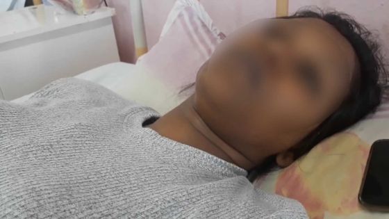 Agression le jour de son mariage - La victime : «Ils n’ont pas apprécié que j’éteigne la sono»