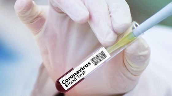 Santé - COVID-19 : l’accord qui garantit un vaccin à 20 % de la population