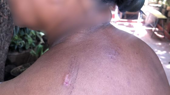 Violence à l’égard des vieux - Fiona : «Mo ti zanfan inn trangle mwa»