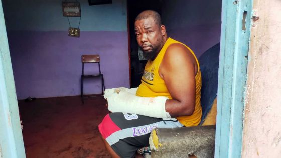 Agressé violemment à Flic-en-Flac le 5 janvier dernier - Louis Berthe Beau Yeux : «Mo bann zanfan inn al lekol san manze, monn asize monn plore»