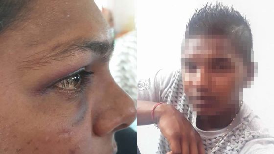 Allégation de viol à Dubreuil - Pooja : «Li dir mwa pa bouze, sinon mo pik to garson»