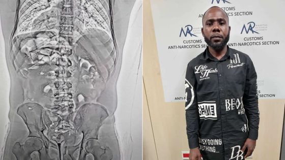 Arrêté à l’aéroport vendredi : le Nigérian restitue 75 boulettes de cocaïne au total