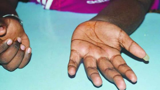 Attaquée dans son commerce : une veuve secourue par ses quatre chiens et son fils