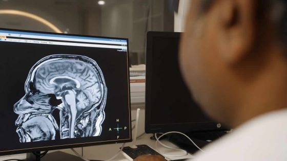 Questions à…Arunprasath Govindaraj Selvaraju, Head of Clinical Engineering de Falcon Healthcare Group : «L’IRM 3D affiche la région scannée de manière plus exhaustive»