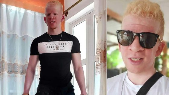 Cedrick Jean Pierre, tiktokeur : « Les persécutions ont brisé ma jeunesse »